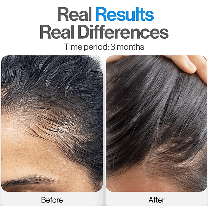 Hair Growth Roll - On Serum - vymanel