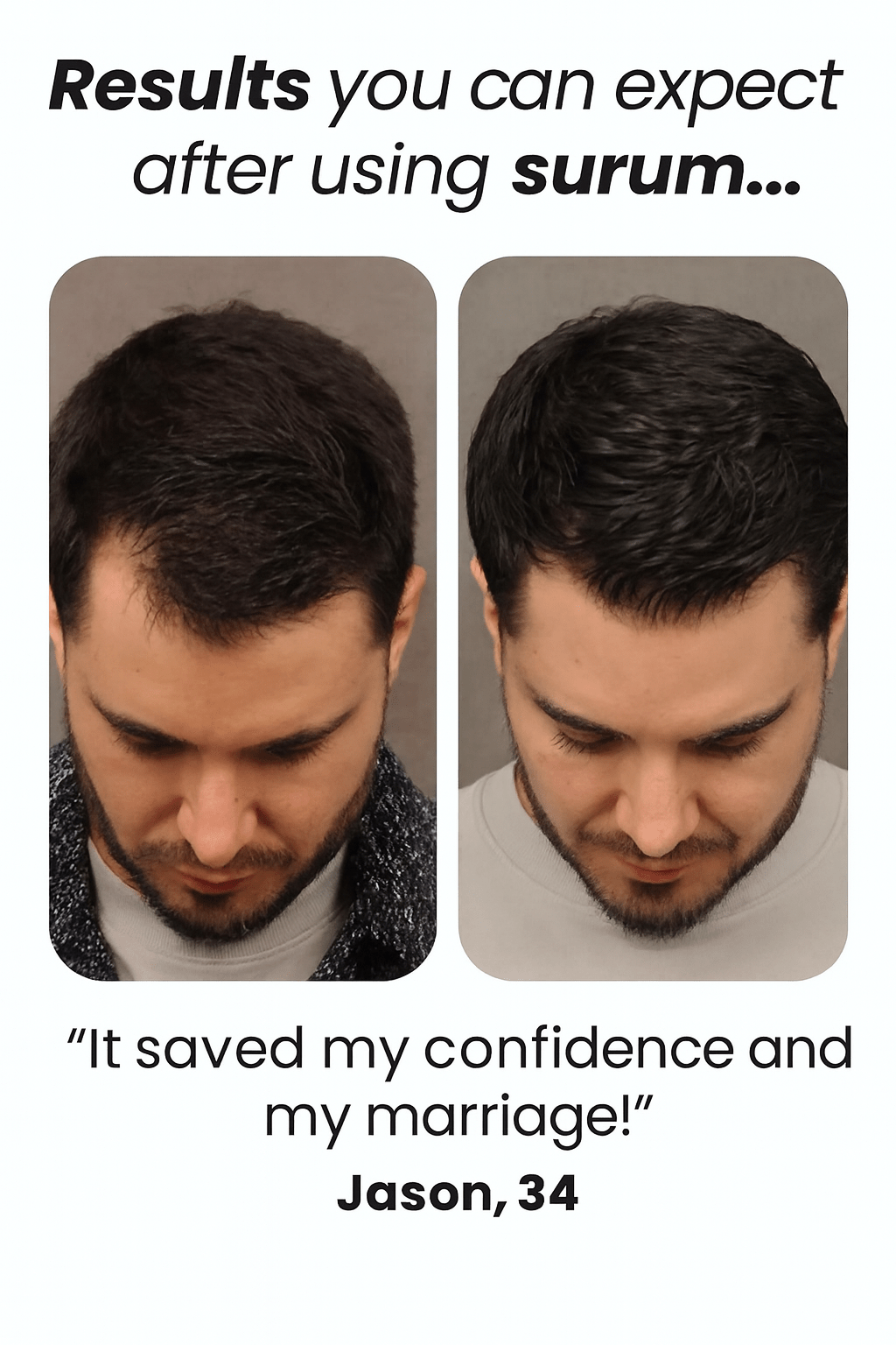 Hair Growth Roll - On Serum - vymanel